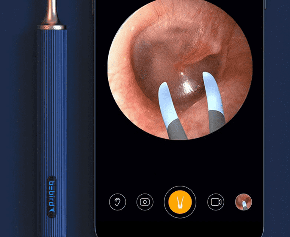 Изображение с камеры умной ушной палочки Xiaomi Bebird Note 3 PRO Smart Visual Spoon Ear Stick